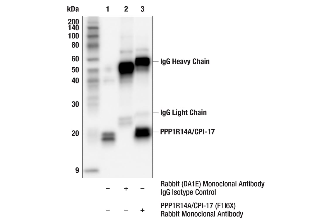 Immunoprecipitation Image 1: PPP1R14A/CPI-17 (F1I6X) Rabbit Monoclonal Antibody