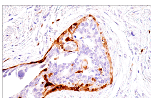 Immunohistochemistry Image 4: S100B (E7C3A) Rabbit Monoclonal Antibody