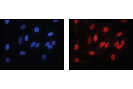 undefined Image 40: HSP/Chaperone Antibody Sampler Kit