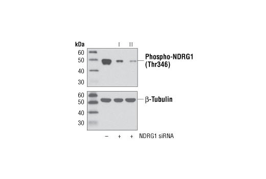 Western Blotting Image 2: Phospho-NDRG1 (Thr346) (D98G11) Rabbit Monoclonal Antibody (BSA and Azide Free)