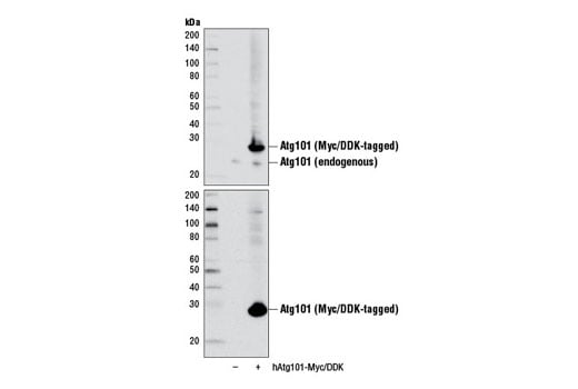 undefined Image 10: Autophagy Induction (ULK1 Complex) Antibody Sampler Kit