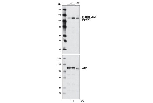 undefined Image 10: ALK Activation Antibody Sampler Kit
