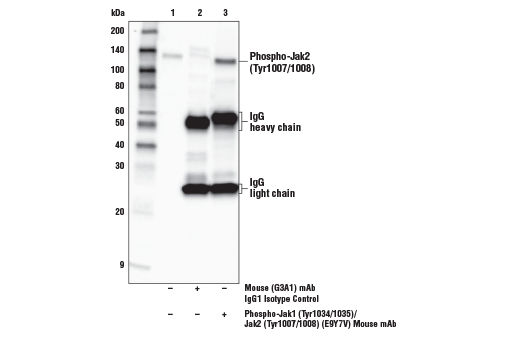Immunoprecipitation Image 1: Phospho-Jak1 (Tyr1034/1035)/Jak2 (Tyr1007/1008) (E9Y7V) Mouse Monoclonal Antibody
