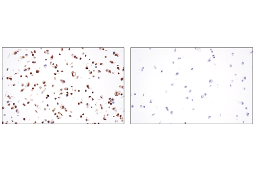 Immunohistochemistry Image 2: GATA-3 (E2N1Y) Mouse Monoclonal Antibody (BSA and Azide Free)