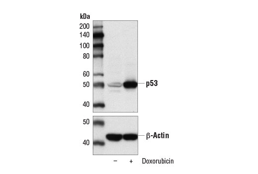 Western Blotting Image 2: p53 (DO-7) Mouse Monoclonal Antibody