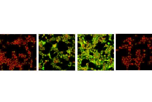 shsat4ページ Acetyl-Histone H4 (Lys16) (E2B8W) Rabbit mAb | Cell