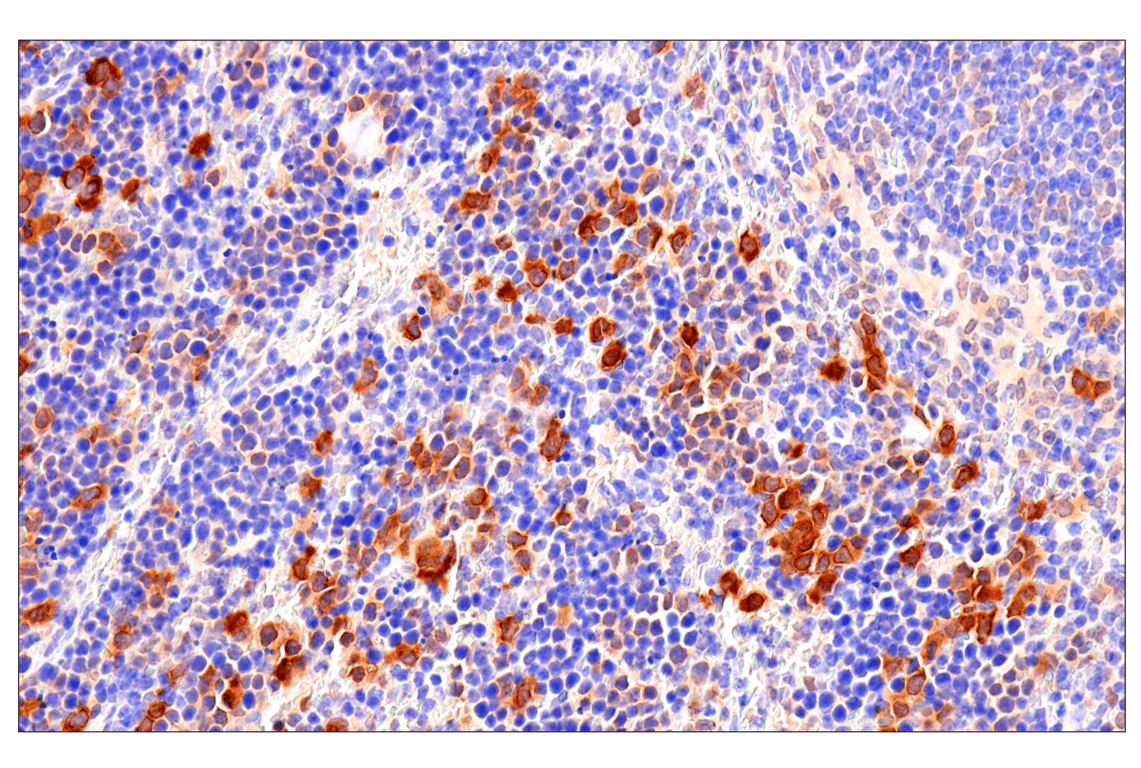 Immunohistochemistry Image 13: CDK6 (E3E3Q) Rabbit Monoclonal Antibody
