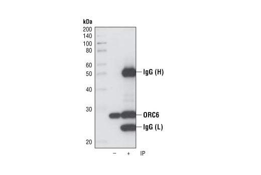 Immunoprecipitation Image 1: ORC6 (3A4) Rat Monoclonal Antibody