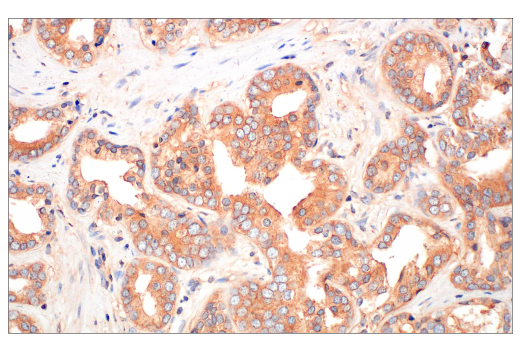 Immunohistochemistry Image 3: Ras (E8N8L) Rabbit Monoclonal Antibody (BSA and Azide Free)
