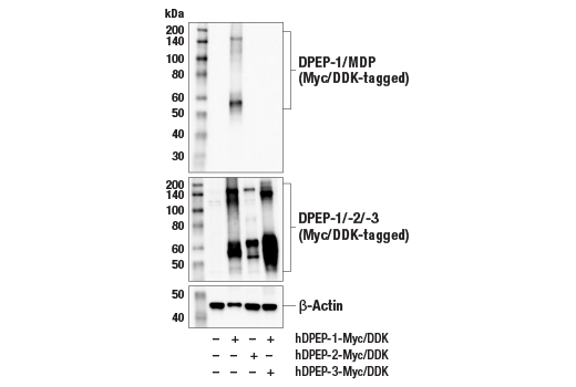 Western Blotting Image 3: DPEP-1/MDP (E5C2V) Rabbit Monoclonal Antibody
