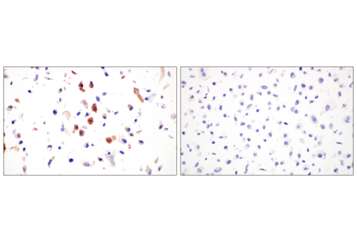 Immunohistochemistry Image 3: SARS-CoV-2 Nucleocapsid Protein (HL344) Rabbit Monoclonal Antibody