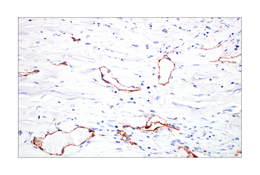Immunohistochemistry Image 2: CD31 (PECAM-1) (89C2) Mouse Monoclonal Antibody (BSA and Azide Free)