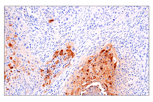 Immunohistochemistry Image 2: S100A7 (E7X2C) Rabbit Monoclonal Antibody