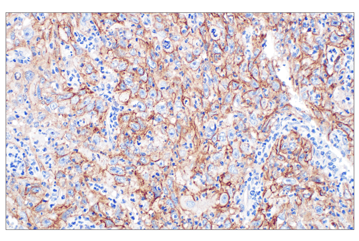 Immunohistochemistry Image 4: CD44 v5 (C44Mab-3) Mouse Monoclonal Antibody