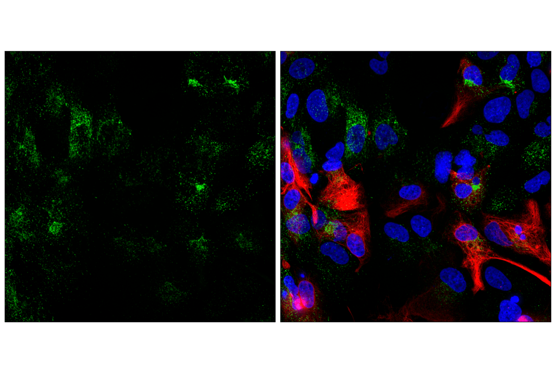 Immunofluorescence Image 1: AQP4 (D1F8E) Rabbit Monoclonal Antibody