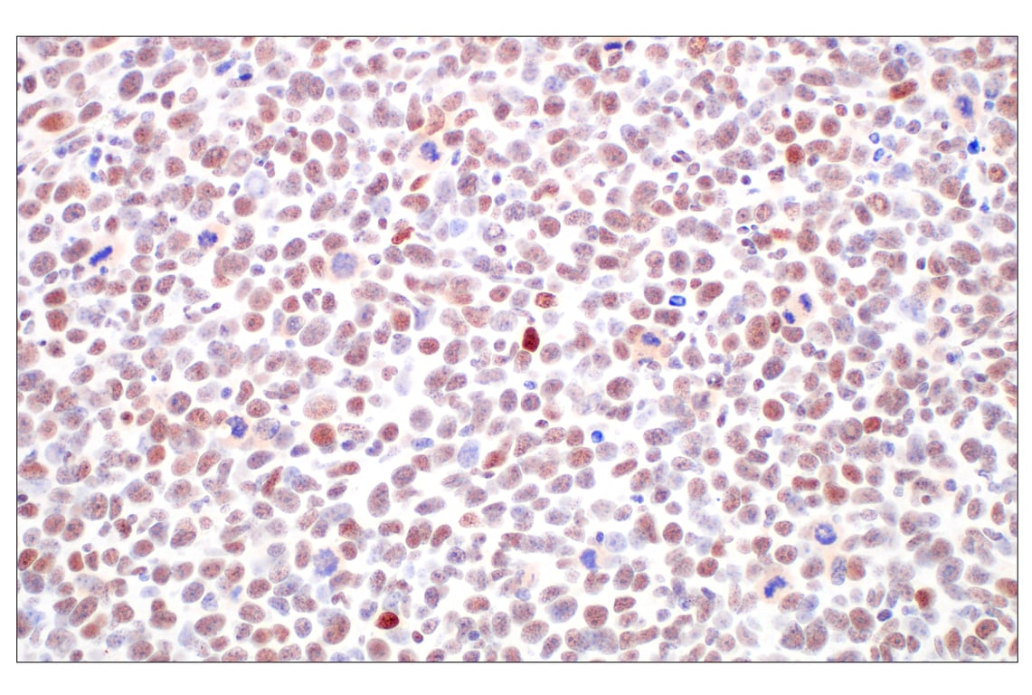 Immunohistochemistry Image 9: Basic FGF (E5Y6M) Rabbit Monoclonal Antibody