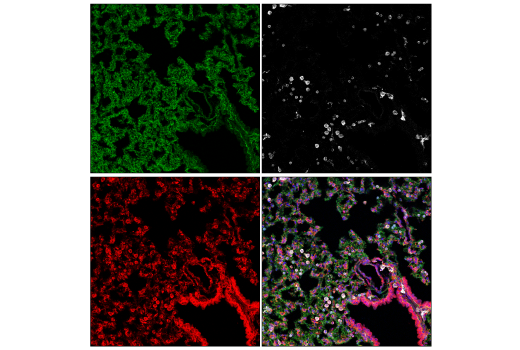 Immunofluorescence Image 4: Phospho-Paxillin (Tyr118) (E9U9F) Rabbit Monoclonal Antibody
