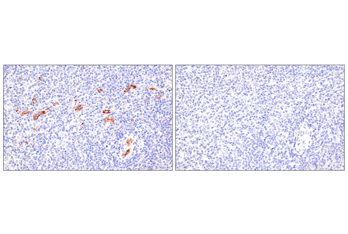 Immunohistochemistry Image 8: Claudin-5 (E5D9Y) Rabbit mAb