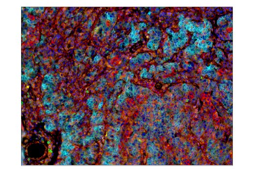 Immunohistochemistry Image 6: TIM-3 (D5D5R) Rabbit Monoclonal Antibody (BSA and Azide Free)