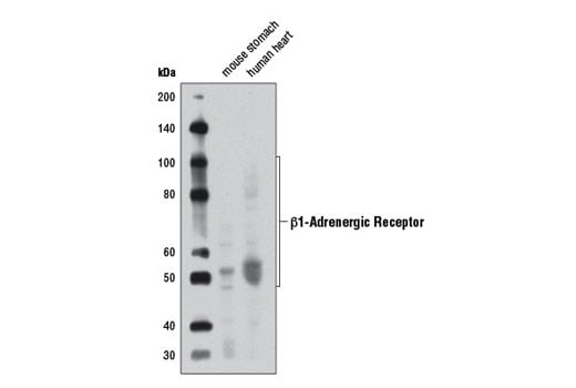 Western Blotting Image 1: β1-Adrenergic Receptor Antibody 