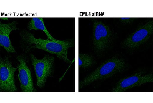 Immunofluorescence Image 1: EML4 (D7Y8F) Rabbit Monoclonal Antibody