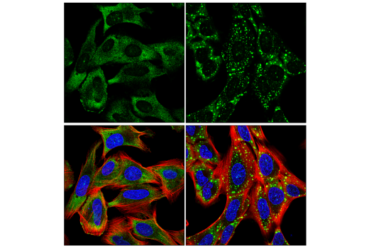 Immunofluorescence Image 2: YTHDF1 (E8R5L) Rabbit Monoclonal Antibody
