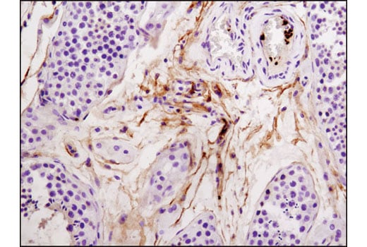 Immunohistochemistry Image 1: Integrin beta3 (D7X3P) Rabbit Monoclonal Antibody (BSA and Azide Free)