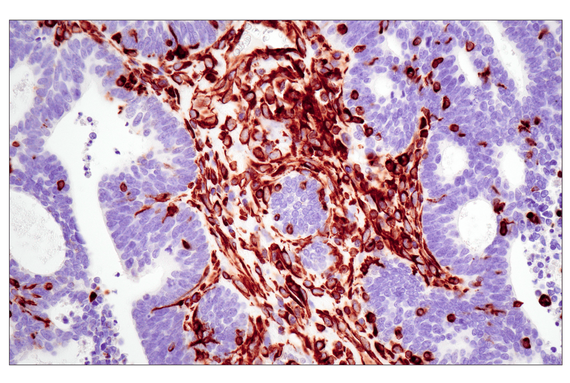 Immunohistochemistry Image 2: Vimentin (D21H3) Rabbit Monoclonal Antibody (BSA and Azide Free)