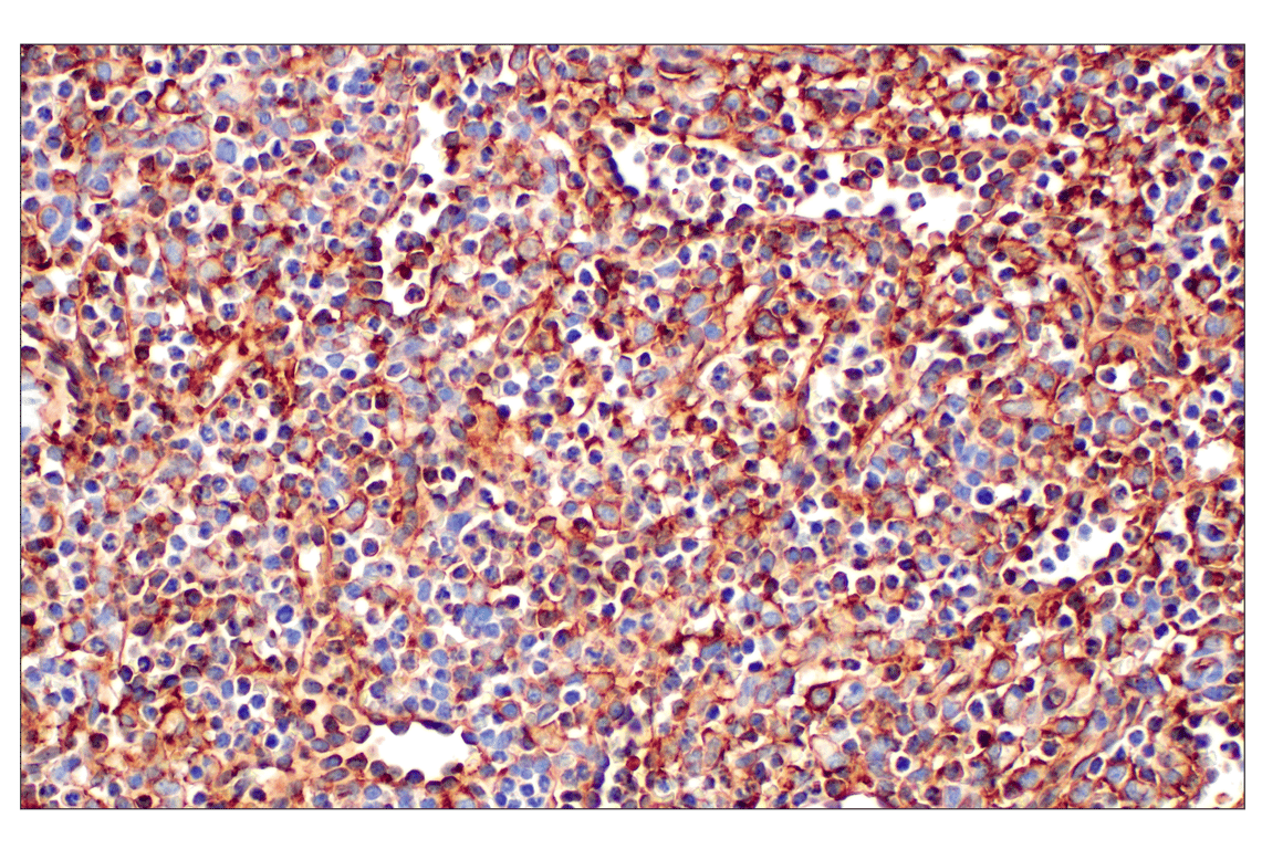 Immunohistochemistry Image 3: CD31 (PECAM-1) (F8M3S) Rabbit Monoclonal Antibody