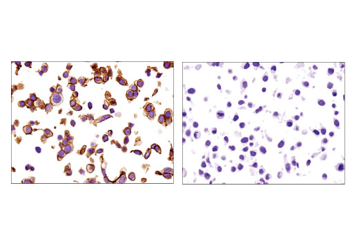 Immunohistochemistry Image 3: E-Cadherin (4A2) Mouse Monoclonal Antibody (BSA and Azide Free)
