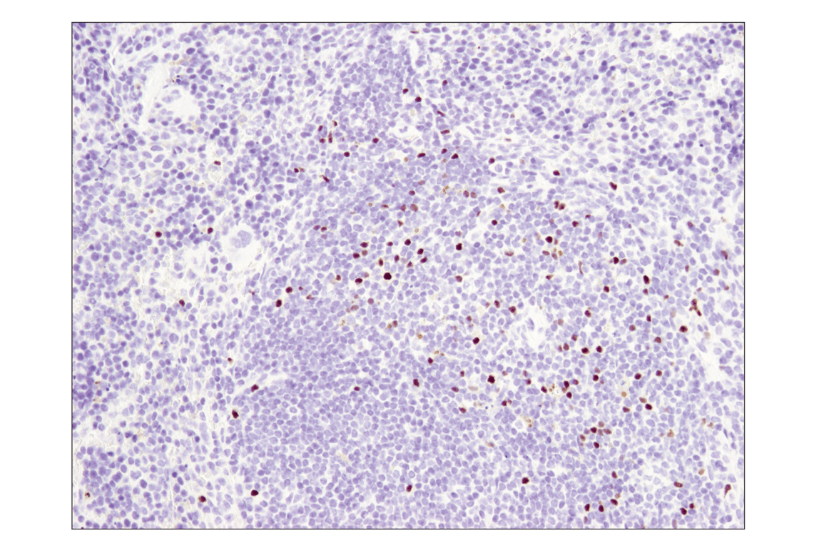 Immunohistochemistry Image 2: FoxP3 (D6O8R) Rabbit Monoclonal Antibody (BSA and Azide Free)