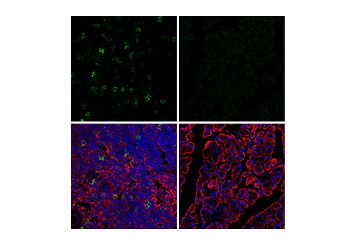 Immunofluorescence Image 1: GITR (E9O9H) Rabbit Monoclonal Antibody (BSA and Azide Free)