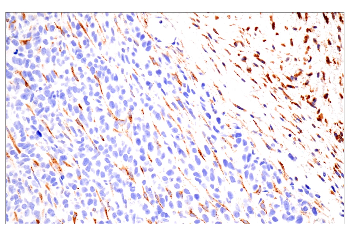 Immunohistochemistry Image 4: Cathepsin K (E7U5N) Rabbit Monoclonal Antibody