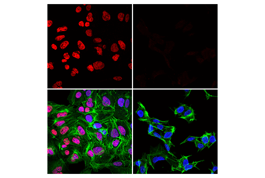 Immunofluorescence Image 1: FoxA2/HNF3β (D56D6) XP<sup>®</sup> Rabbit mAb (Alexa Fluor<sup>®</sup> 555 Conjugate)
