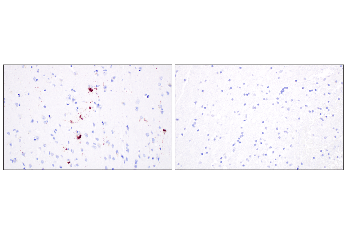 Immunohistochemistry Image 2: Phospho-TDP43 (Ser409/Ser410) (F9S3F) Rabbit Monoclonal Antibody