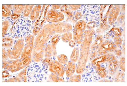 Immunohistochemistry Image 2: Cathepsin D (E7Z4L) XP<sup>®</sup> Rabbit mAb (BSA and Azide Free)