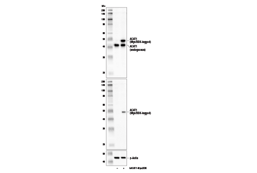 Western Blotting Image 2: ACAT1 Antibody