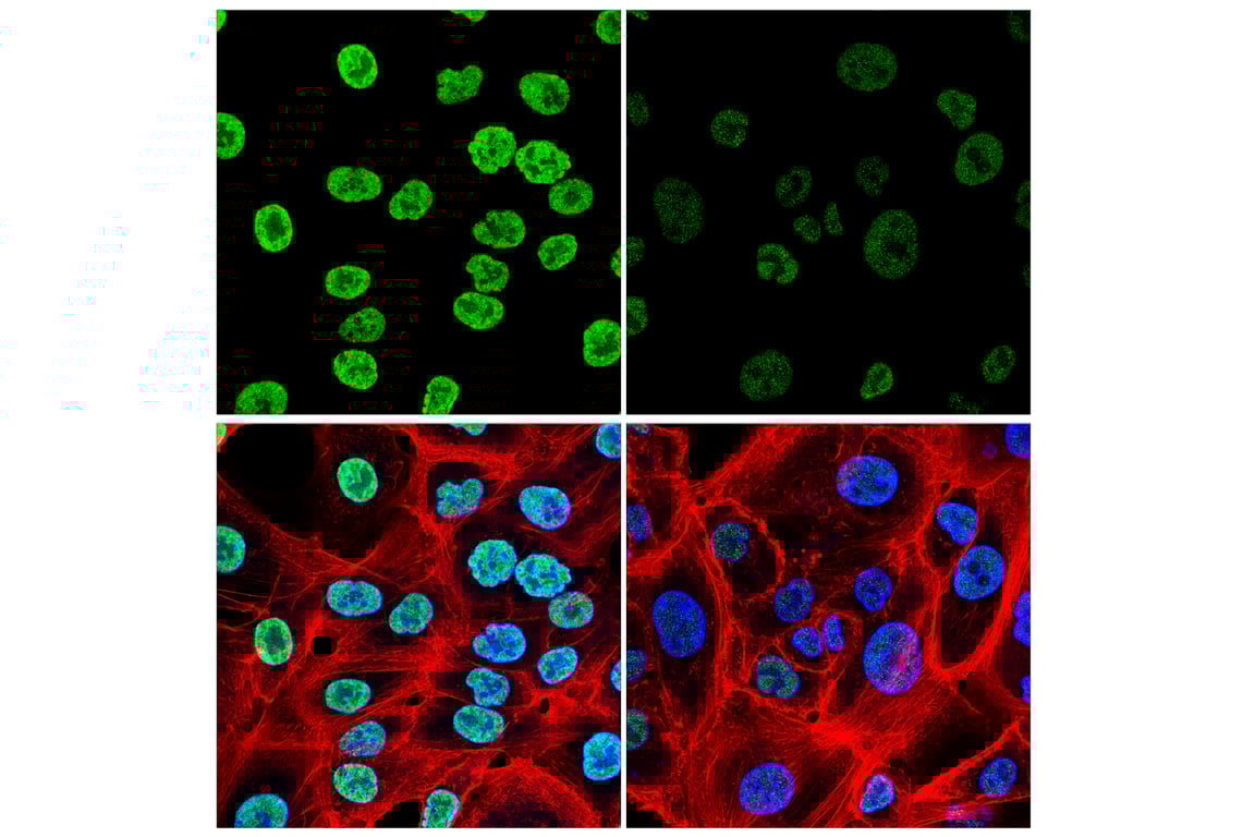 Immunofluorescence Image 1: SAM68 (E6Y2F) Rabbit Monoclonal Antibody