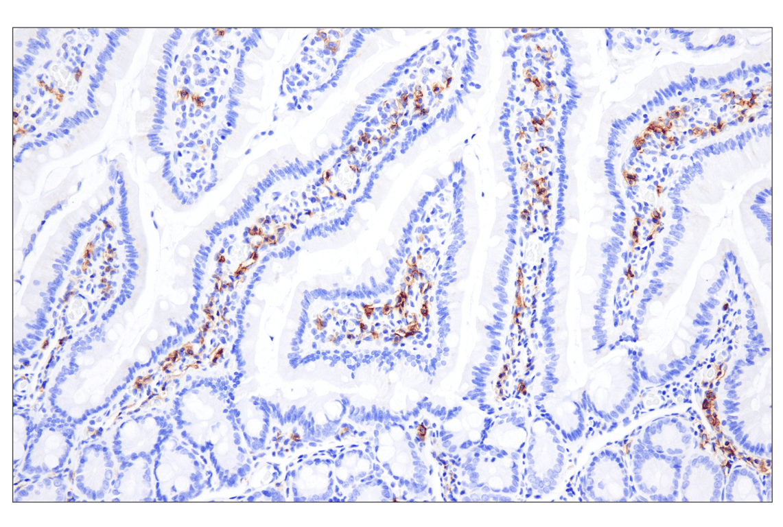 Immunohistochemistry Image 4: CD20 (E3N7O) Rabbit Monoclonal Antibody