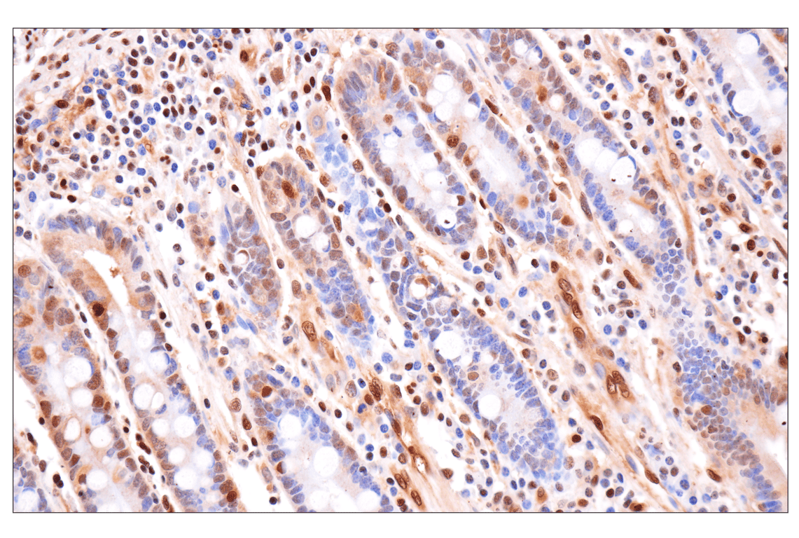 Immunohistochemistry Image 5: Phospho-ATP-Citrate Lyase (Ser455) (F4T8R) Rabbit Monoclonal Antibody