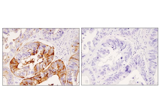 Immunohistochemistry Image 2: DPP4/CD26 (D6D8K) Rabbit Monoclonal Antibody (IHC Formulated)