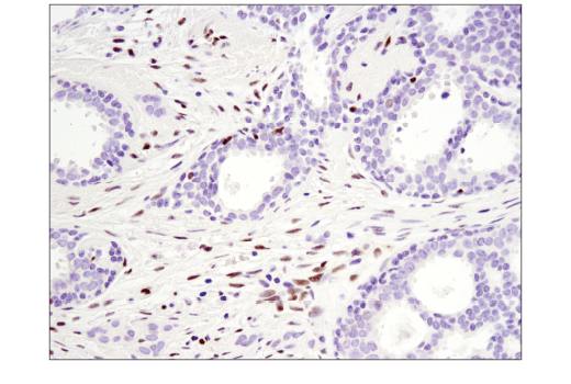 Immunohistochemistry Image 1: SLFN11 (D8W1B) Rabbit Monoclonal Antibody