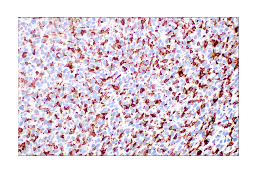 Immunohistochemistry Image 1: CD206/MRC1 (E6T5J) Rabbit Monoclonal Antibody