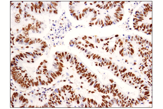 Immunohistochemistry Image 1: Asymmetric Dimethyl-SMARCC1/BAF155 (Arg1064) (D8I3U) Rabbit Monoclonal Antibody