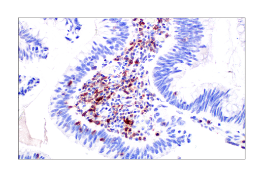 Immunohistochemistry Image 3: TIGIT (E5Y1W) Rabbit Monoclonal Antibody