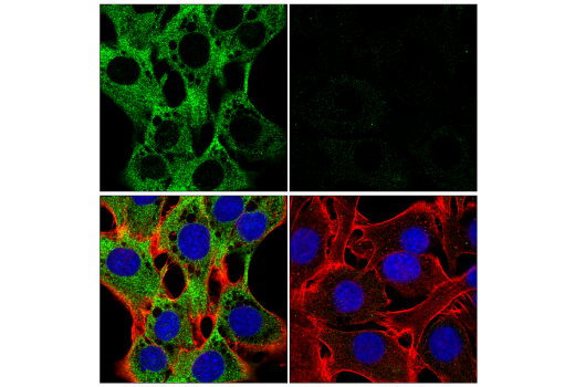 Immunofluorescence Image 1: Calpain 2 Large Subunit (M-type) (E3M6E) Rabbit Monoclonal Antibody