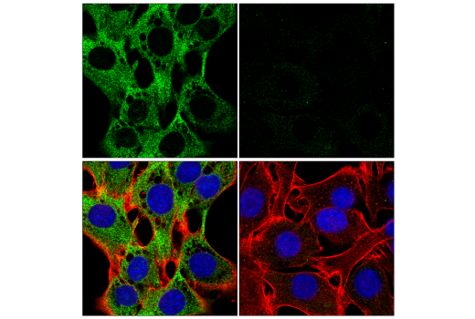 Immunofluorescence Image 1: Calpain 2 Large Subunit (M-type) (E3M6E) Rabbit mAb