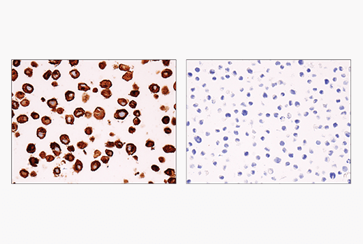 Immunohistochemistry Image 2: IL-13RA2/CD213a2 (E7U7B) Rabbit Monoclonal Antibody