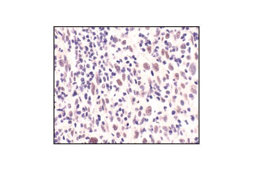 undefined Image 15: Double Strand Breaks (DSB) Repair Antibody Sampler Kit