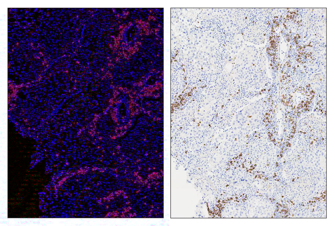 Immunohistochemistry Image 6: CD20 (E7B7T) & CO-0011-488 SignalStar<sup>™</sup> Oligo-Antibody Pair